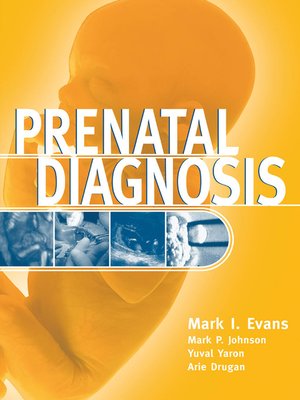 cover image of Prenatal Diagnosis
